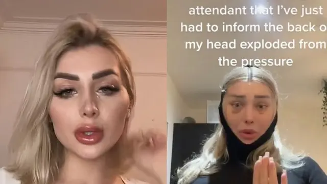 Weronika seorang model OnlyFans kepalanya meledak usai operasi