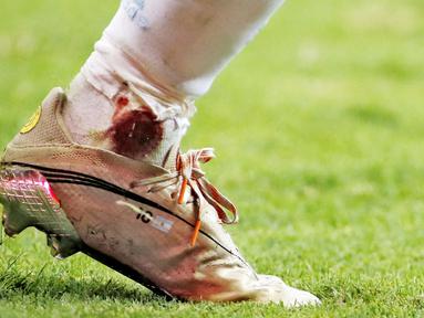 Megabintang Lionel Messi tampil heroik saat membawa Argentina menaklukkan Kolombia pada laga semifinal Copa America 2021. Meski dalam kondisi kaki berdarah ia tetap berjuang dan bermain penuh. (Foto:AFP/Silvio Avila)