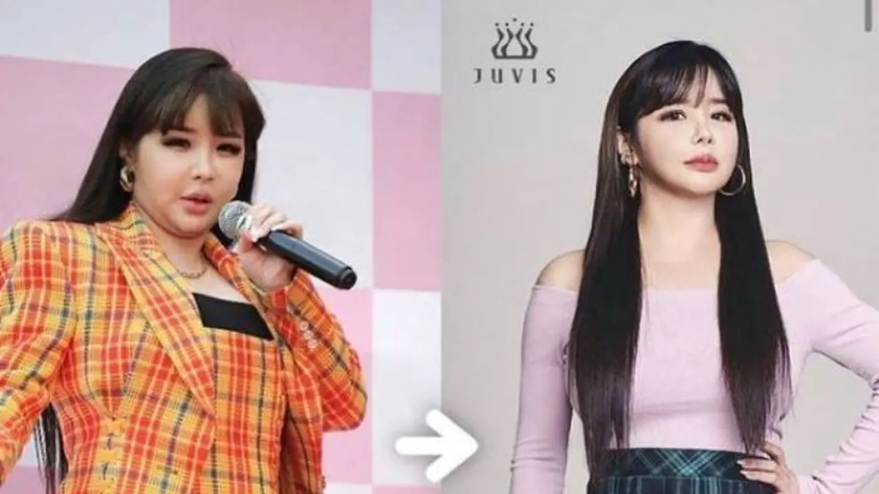 Park Bom dan Banyak Artis Korea Sukses Turunkan Berat Badan Karena Juvis Diet