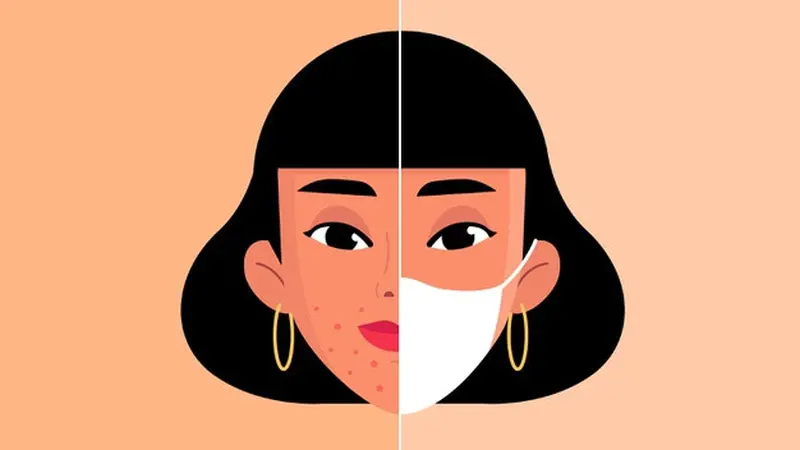 Gambar Ilustrasi Maskne, Jerawat Karena Sering Pakai Masker