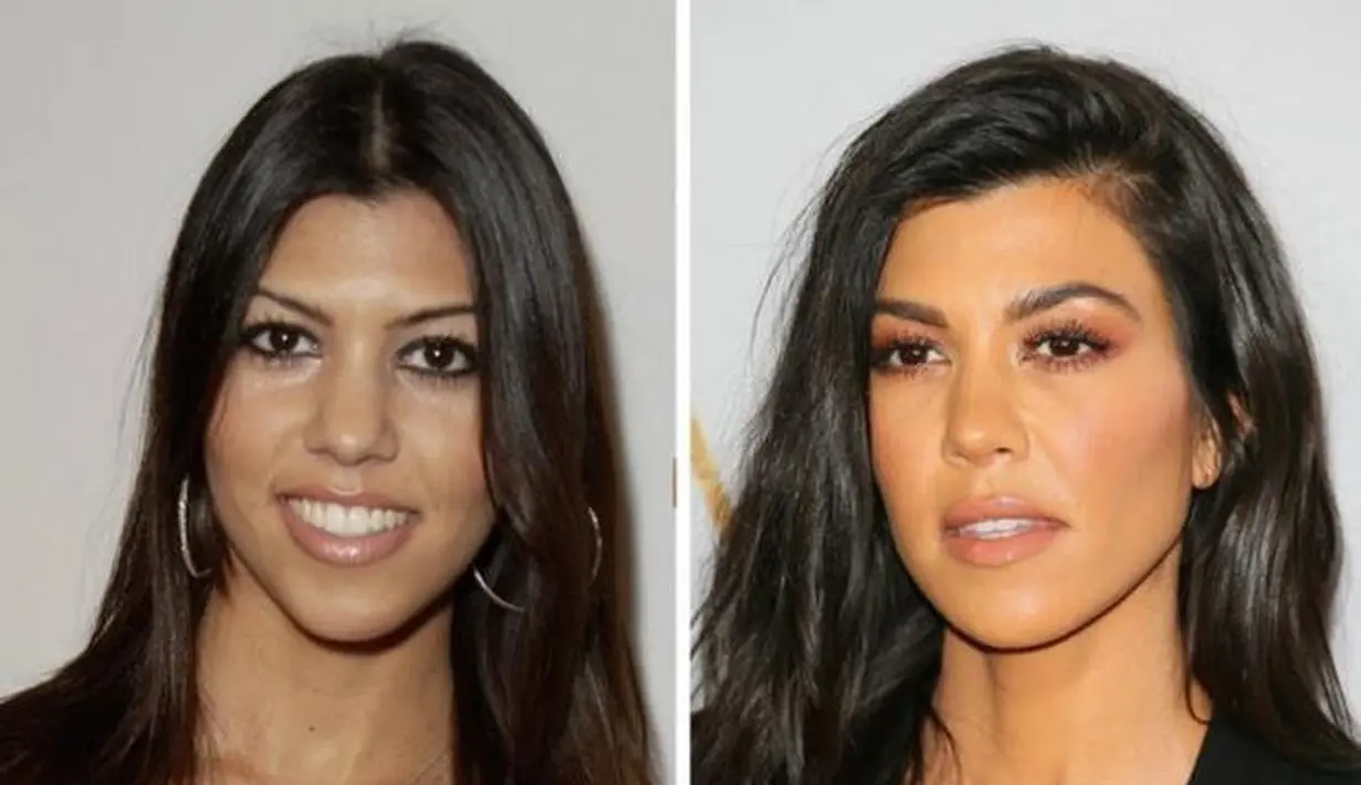 Meski perubahannya tak terlalu nampak seperti yang lain. Namun terlihat bahwa Kourtney pun melakukan sesuatu pada bibirnya. (Life&Style)