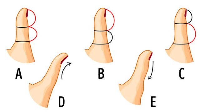 5 Bentuk Jempol Ini Ungkap Rahasiamu, Punya Kamu yang Mana?