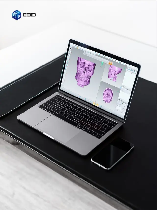 Teknologi 4.0 Berbasis 3D Print Terobosan Baru di Dunia Kesehatan