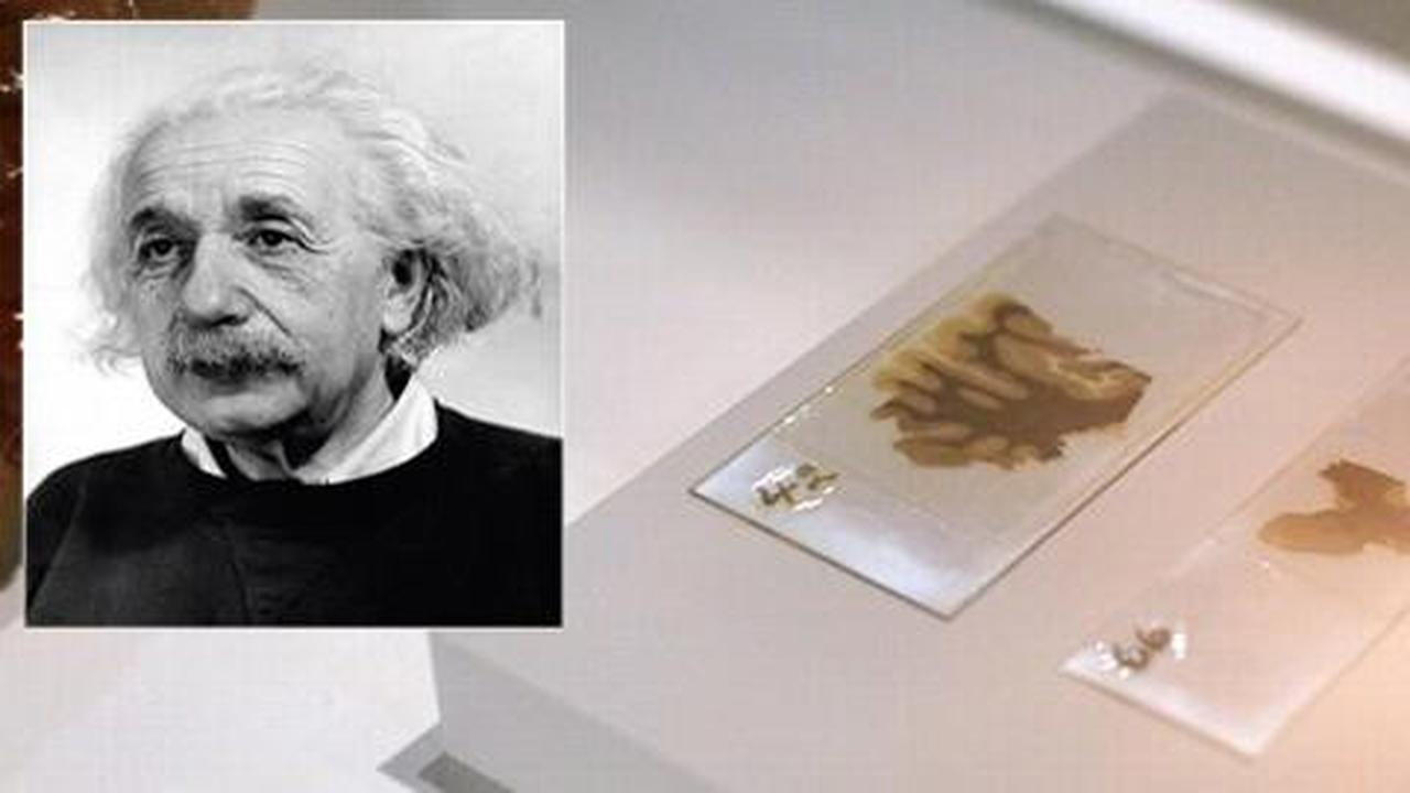 Otak Albert Einstein berbeda dari manusia pada umumnya
