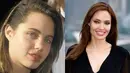 Bahkan aktris secantik Angelina Jolie pun pernah memakai kawat gigi. (dailymix.info)