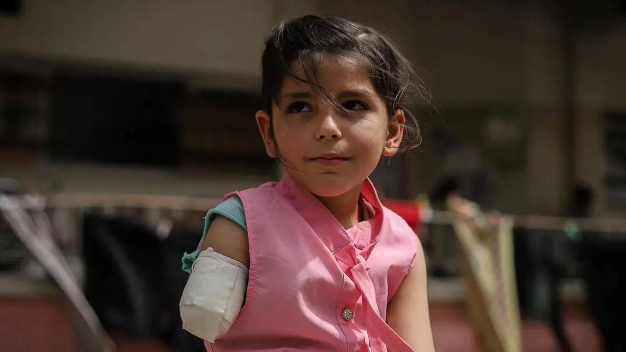 1.000 Anak Palestina Diamputasi Karena Perang Genosida Israel di Gaza, 'Hidupku Berubah Selamanya, Aku Kehilangan Kaki