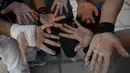  Para pemuda Irak ini menunjukkan tangannya yang penuh luka akibat dari latihan Parkour, Irak, Rabu (14/05/2014) (AFP PHOTO/HAIDER HAMDANI).