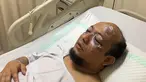 Novel Baswedan saat dirawat di Rumah Sakit Mitra Keluarga Kelapa Gading, Jakarta Utara, Selasa (11/4). Penyidik senior KPK tersebut menjadi korban penyiraman air keras saat pulang Salat Subuh. (AFP Photo/Polri)