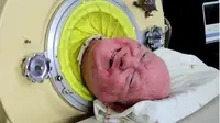 Paul Alexander, pria yang selama 70 tahun hidup dalam silinder paru-paru besi meninggal dunia pada usia 78 tahun. (Foto: Tangkapan Layar gofundme)