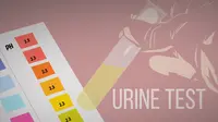 Ilustrasi Tes Urine (Liputan6.com/Johan Fatzry)