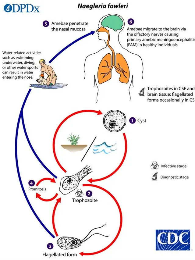 Ilustrasi penularan infeksi amoeba pemakan otak (Naegleria fowleri)