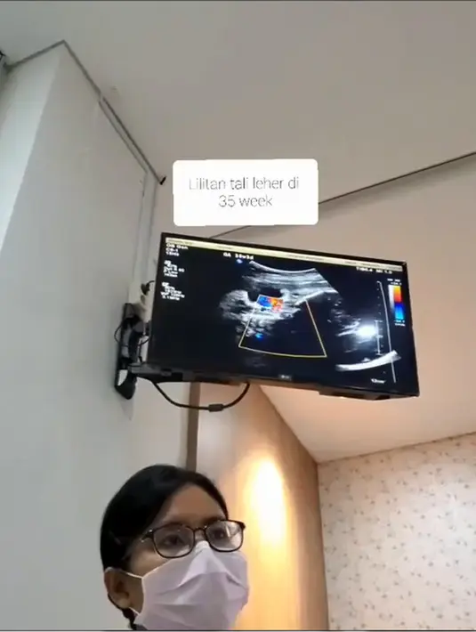 Bebi Silvana (Instagram/bebi.silvana)