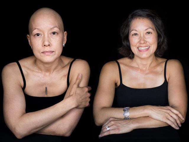 Wanita sebelum kemoterapi dan sesudah kemoterapi karya Robert Hauser | Photo: Copyright huffingtonpost.com