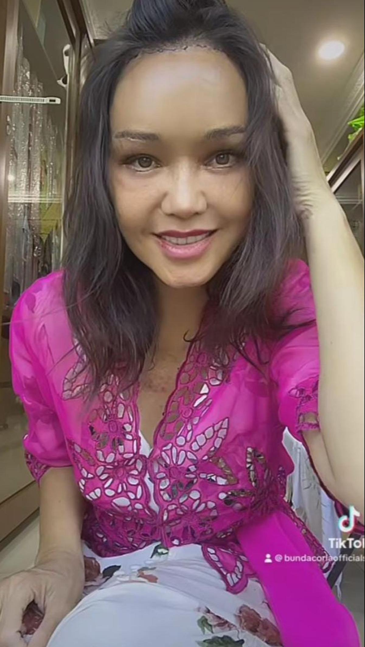 Bunda Corla dibanjiri pujian atas hasil operasi plastiknya yang memukau. Kini, pesonanya semakin bersinar, mencuri hati banyak orang.