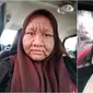 Perubahan wajah wanita hamil seperti nenek-nenek (Sumber: Facebook/Nor Sahira II)