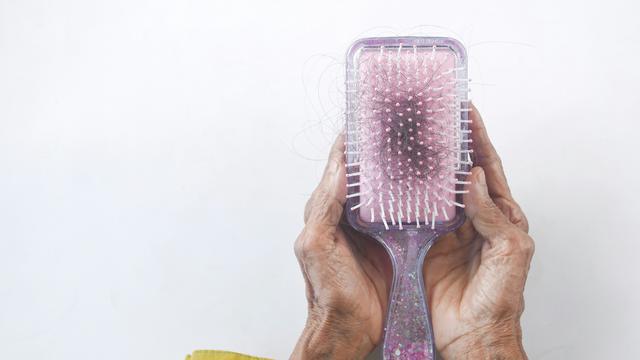 Ilustrasi rambut rontok