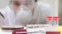Ilustrasi penyakit hepatitis (sumber: iStock)