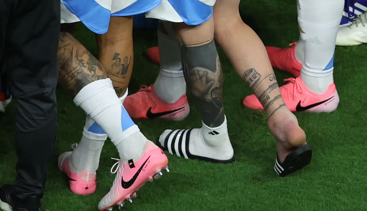 Penampakan bengkak di pergelangan kaki kanan Messi terlihat jelas. (AFP/Megan Briggs)