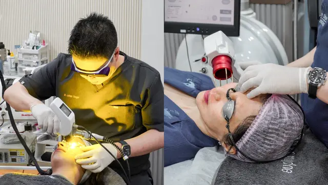 Perawatan Kulit Multistep Laser Disebut Jadi Solusi untuk Berbagai Masalah Wajah, Seefektif Itukah?