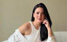 Perjuangan Deretan Artis Indonesia Sembuh dari Kanker Langka, Ada yang Pilih Berobat ke Singapura