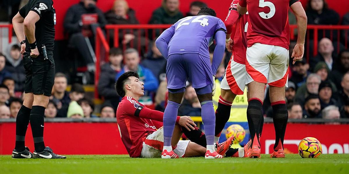 Mikel Arteta Peringatkan Skuad Arsenal: MU Bukan Lawan yang Sepele!