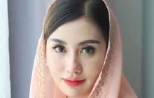 Potret Novita Hardini Istri Bupati Trenggalek, Cantiknya Kebangetan dan Punya Segudang Prestasi