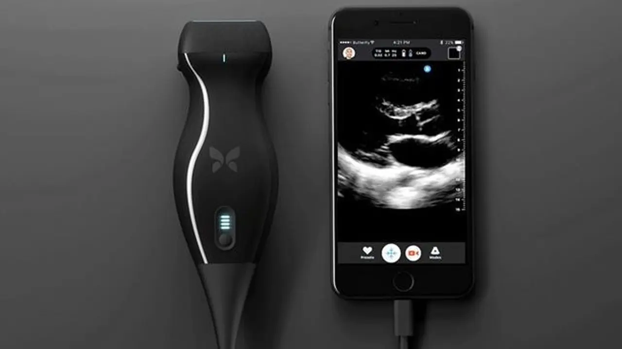 Canggih, Dokter Berhasil Temukan Kankernya Sendiri Pakai iPhone