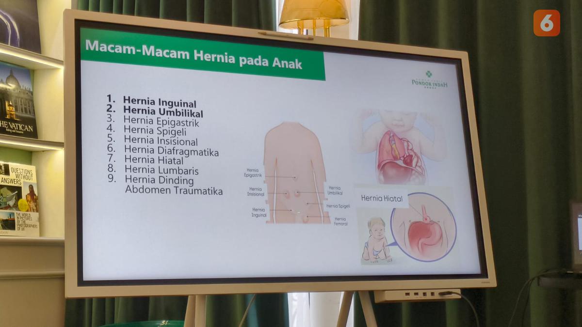 Ada Benjolan Hilang Timbul di Pusar Anak, Waspada Gejala Hernia