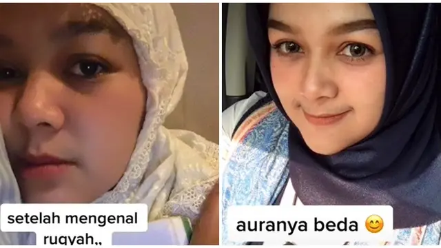 Viral Perubahan Wajah Wanita Sebelum dan Sesudah Ruqyah Ini Bikin Takjub