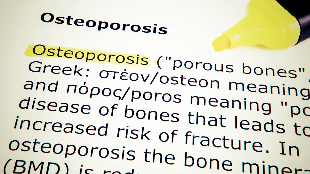 Osteoporosis (iStockphoto)