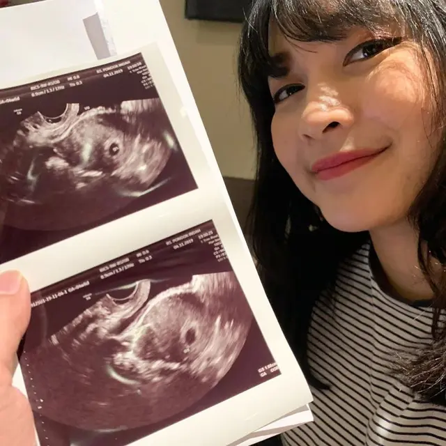 Potret perjalanan kehamilan Kinal Eks JKT48