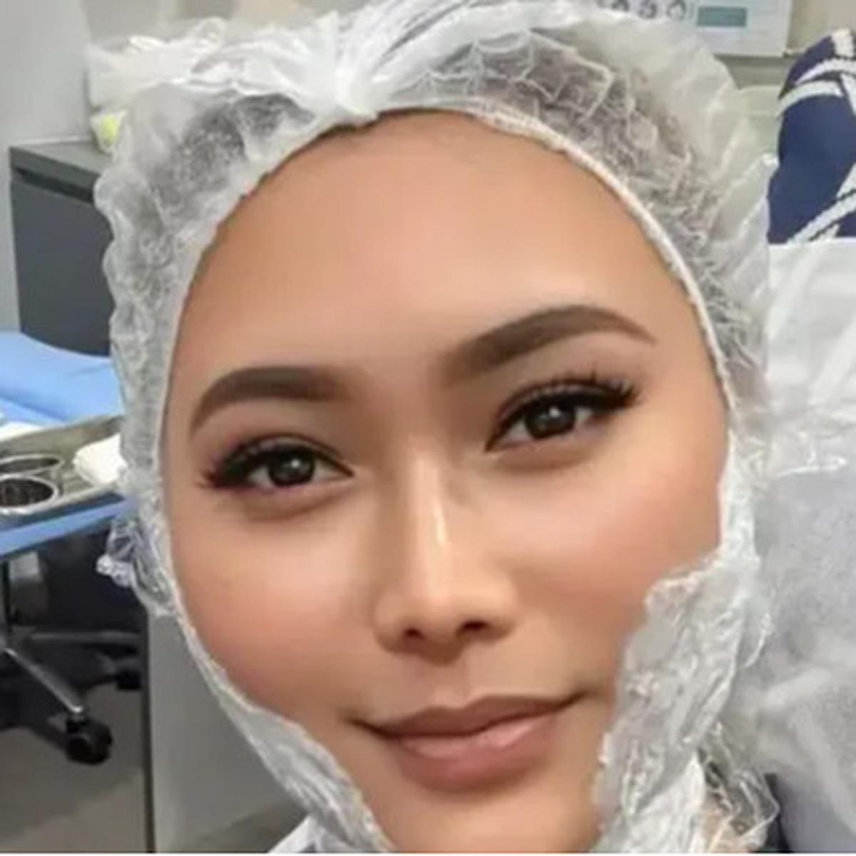 Wajah Tirus dan Awet Muda Ala Inul Daratista