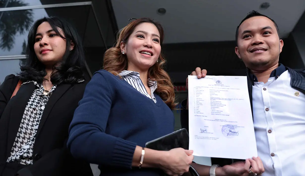 Kerja sama terjadi pada 28 Januari 2016 silam untuk pemotretan kalender tahun 2017. Namun ia kaget, lantaran tidak hanya digunakan dalam kalender, melainkan muncul dalam beberapa brand. (Deki Prayoga/Bintang.com)