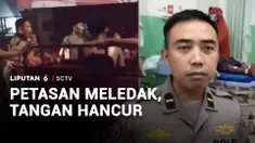 Jangan coba-coba main petasan, karena efeknya bisa fatal. Di Bangkalan, Jawa Timur, tangan kiri seorang remaja hilang sebagian, akibat bubuk mesiu yang meledak saat main petasan.