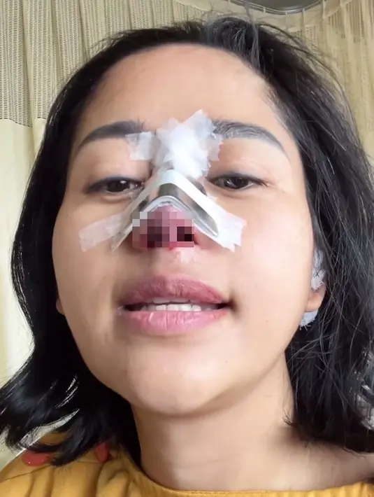 Farida percaya bahwa operasi kali ini, Tompi akan membuat hidungnya lebih natural dan lebih bagus daripada sebelumnya. [Instagram/farida.nurhan]