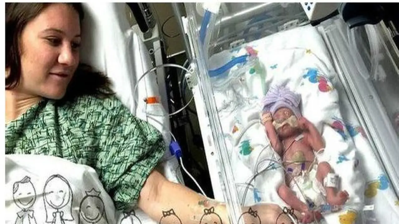 Pertama! Bayi Kembar 5 di AS 