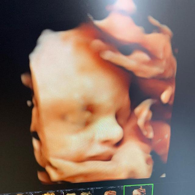 7 Momen Nella Kharisma Periksa Kandungan Bersama Dory Harsa, Pamerkan Hasil USG