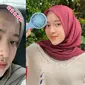 Potret Nissa Sabyan Pede Pamer Foto Berjerawat (Sumber: Instagram/nissa_sabyan)