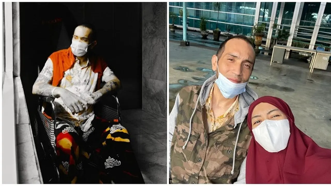 6 Potret Gary Iskak Sudah Boleh Pulang, Usai Dirawat karena Penurunan Fungsi Hati