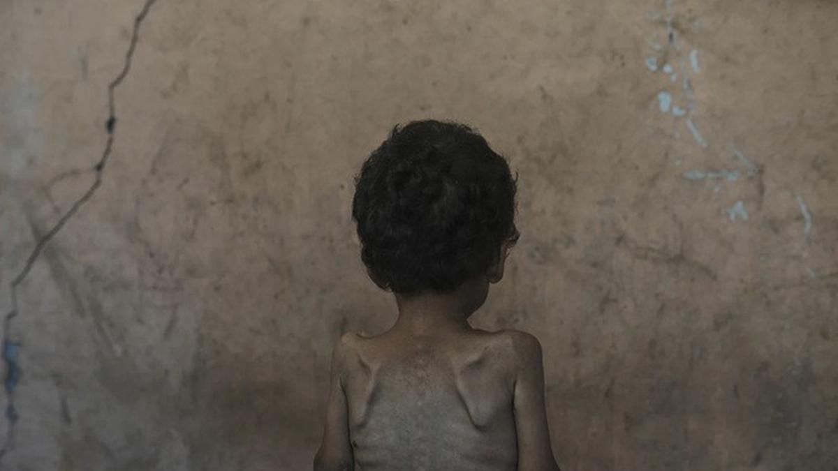 Gaza Menjerit Kelaparan: Warganya Satu per Satu Tumbang di Jalanan