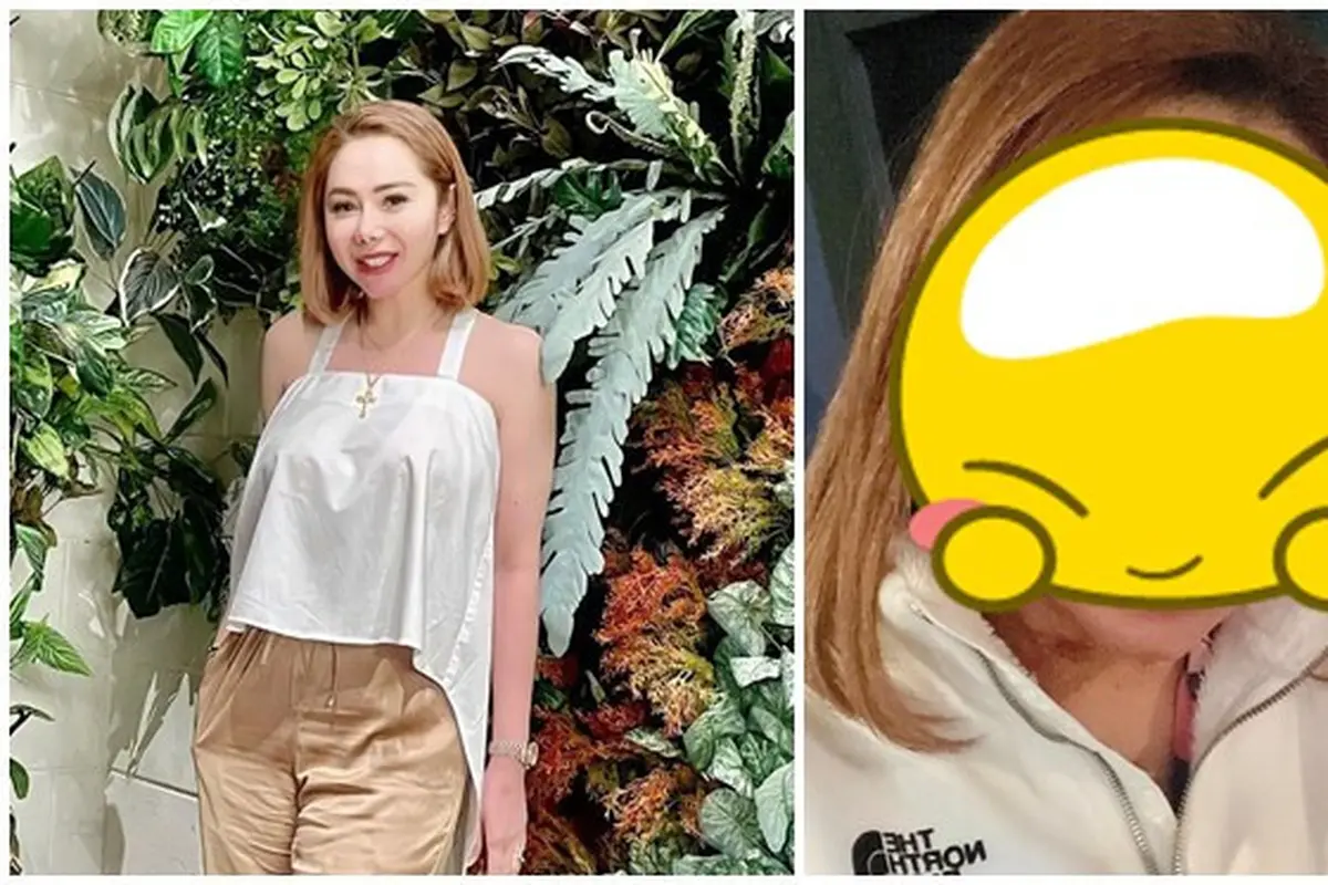 8 Potret Femmy Permatasari Pamer Wajah Usai Lakukan Operasi Plastik, Curi Perhatian