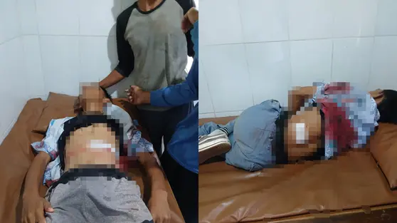 Pelajar SMA Lampung Duel dengan Begal, Tumbang Diterjang Peluru Menembus Perut