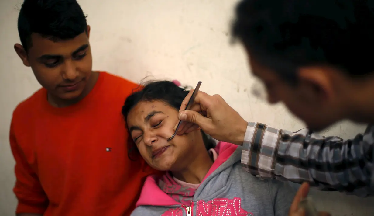 Ekspresi Alya Al-Ghafari, yang menderita cerebral palsy ketika menerima terapi sengatan lebah di klinik Rateb Samour, Kota Gaza, 11 April 2016. Samour mengobati 250 pasien sehari, dengan keluhan dari rambut rontok hingga kanker (REUTERS/Suhaib Salem)