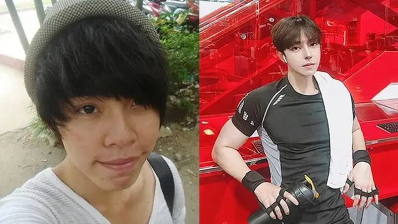 Viral Transformasi Pria Ini Usai Operasi Plastik Bikin Takjub, Bak Idol K-Pop