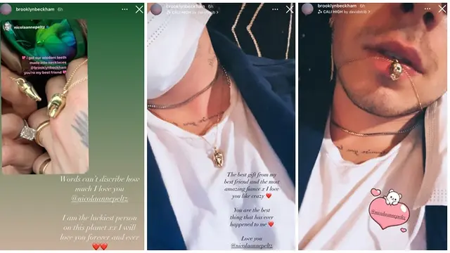 Brooklyn Beckham Dihadiahi Liontin Gigi Emas dari Sang Tunangan