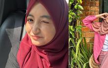 Cerita Kocak Komika Arafah Rianti, Beli Foto Derby Romero Seharga Rp5.000 di Tukang Mainan