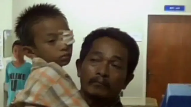 Korban Peluru Pistol Mainan Bertambah Jadi 6 Anak