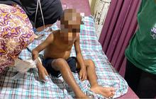 Tega Aniaya Bocah Lima Tahun, Pasutri di Jayapura Diamankan Polisi