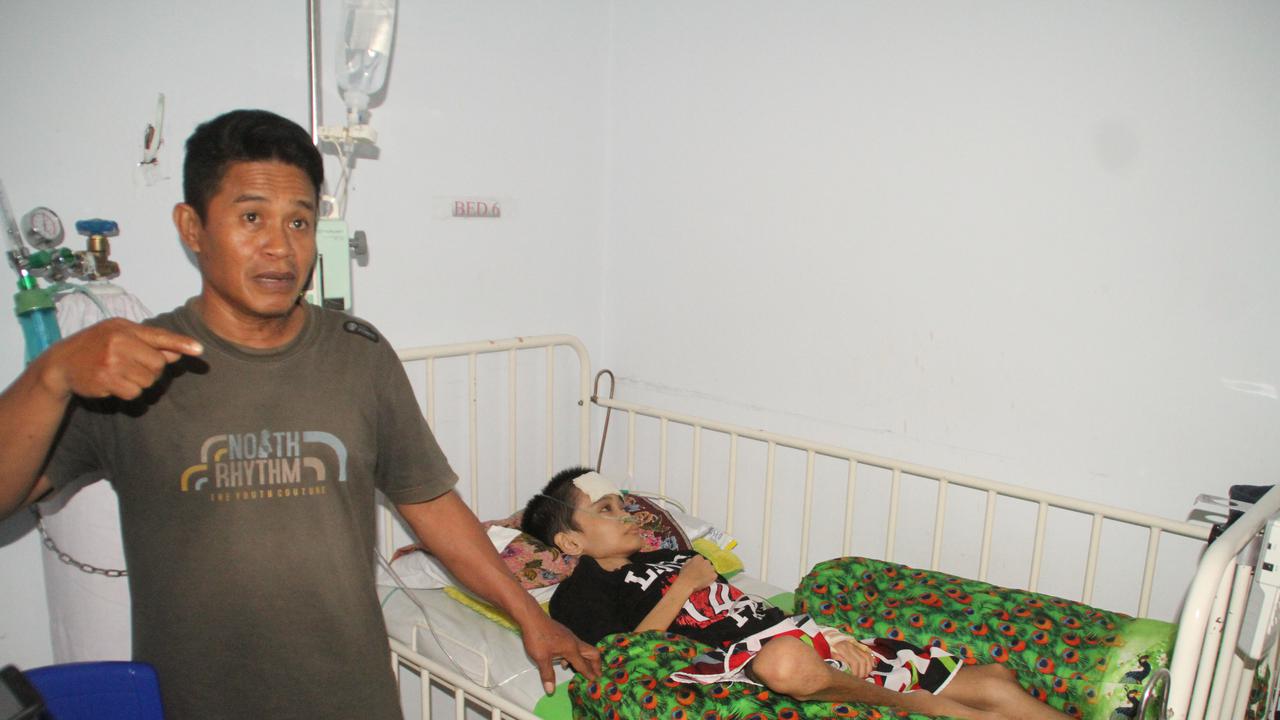 Derita Bocah Gorontalo Pengidap Tumor di Kepala