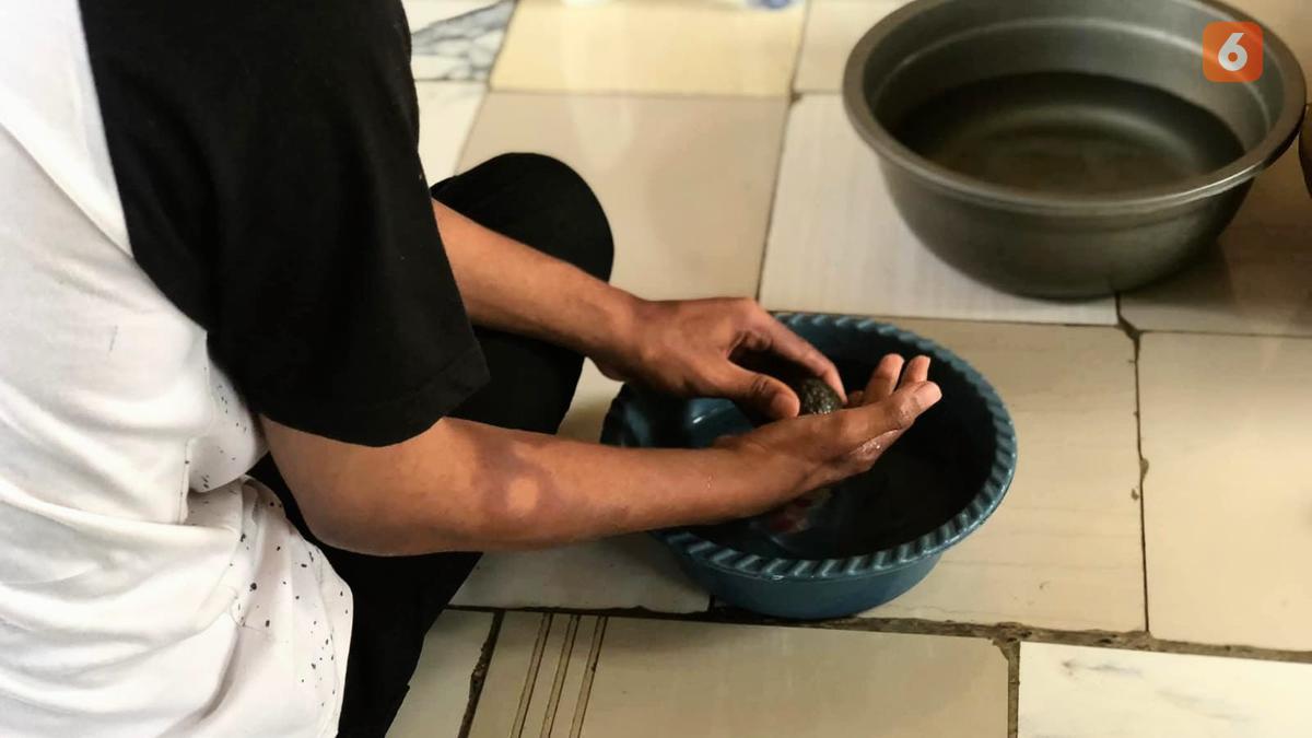 Kusta Dianggap Penyakit Kuno, Dokter: Padahal Indonesia Duduki Peringkat Tiga Jumlah Kasus Tertinggi